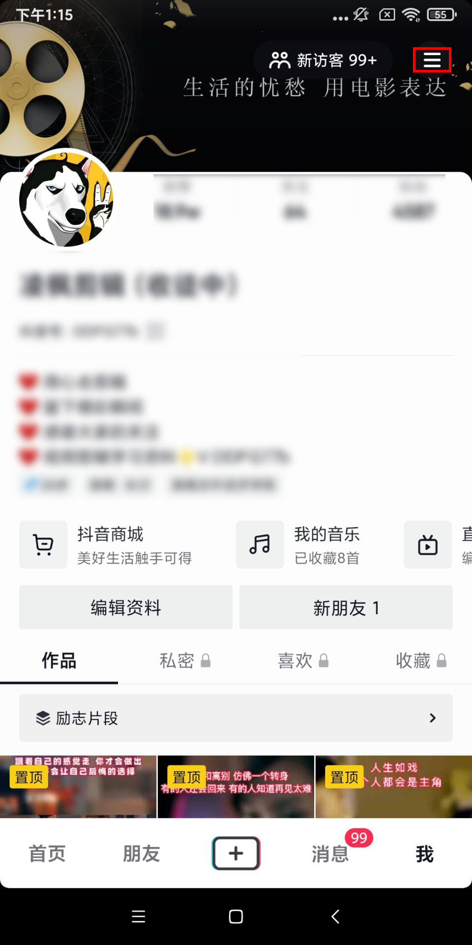 抖音怎么开橱窗（抖音0粉丝怎么开通橱窗）